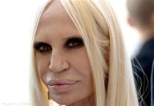 Донателла Версаче шокирует не одеждой, а лицом