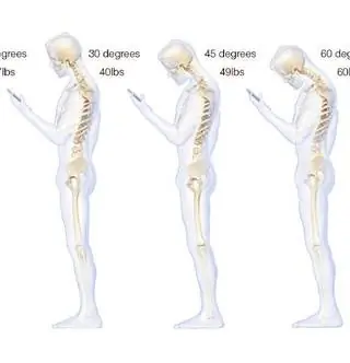 Твоя спина болит? Он слишком много двигается