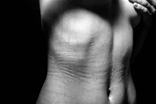 Больше картинок!