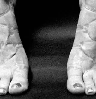 Вот что обтягивающая одежда делает с телом