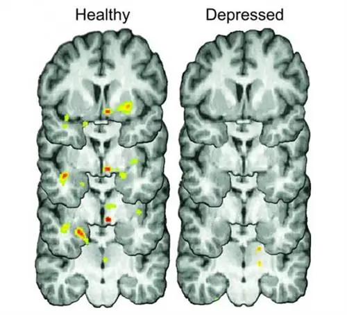 университет Мичигана