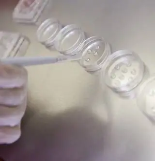 Состояние колбы Cambria можно проверить перед имплантацией