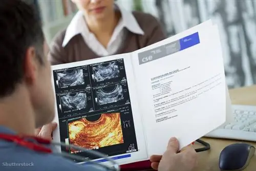 жалюзи 171520838