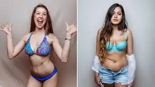 Почему нельзя быть красивой даже при муковисцидозе?