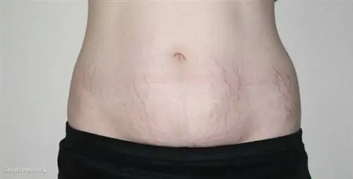 жалюзи 391083166