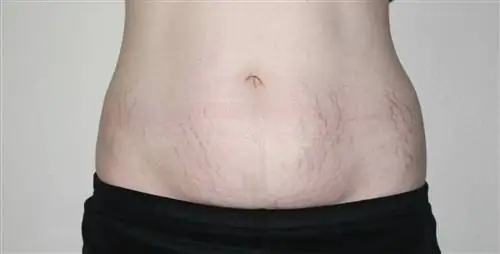 После родов: медийный образ против реальности