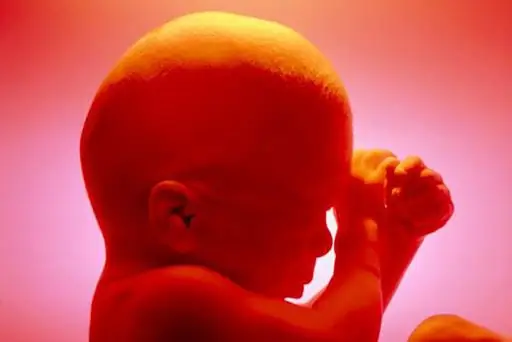 Ложь: заголовок Irish Times вводит публику в заблуждение: 'Первый аборт' Требовать