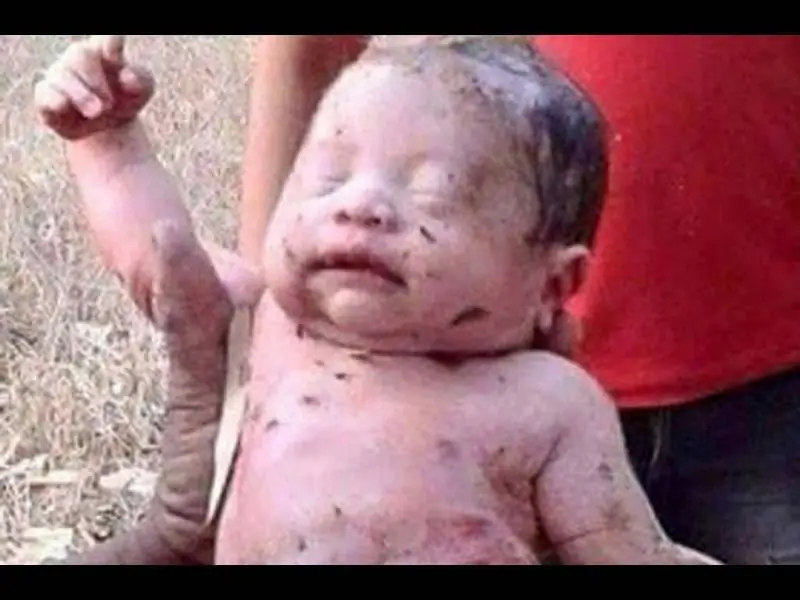 Чудо-ребенок пережил 14 ножевых ранений и был похоронен заживо