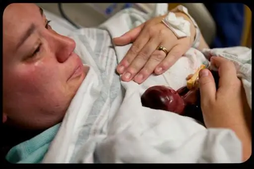 Выкидыш на 19 неделе, ребенок Уолтер's жизнь меняет дебаты об абортах