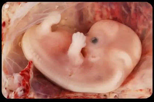 7-недельный эмбрион, который изменил сердца и умы