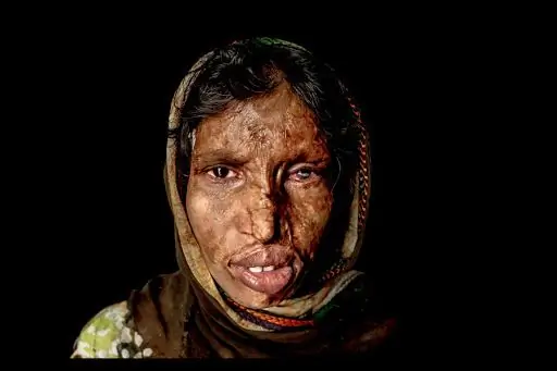 Поцелуи Уродство