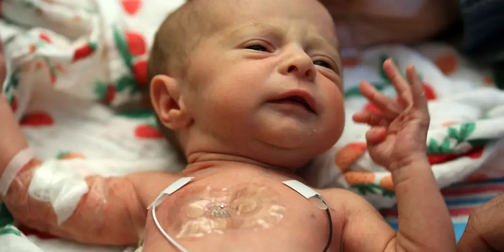 ОРИТ без проводов