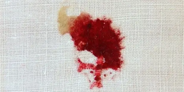 КРОВОТЕЧНЫЙ ХОЗЯИН