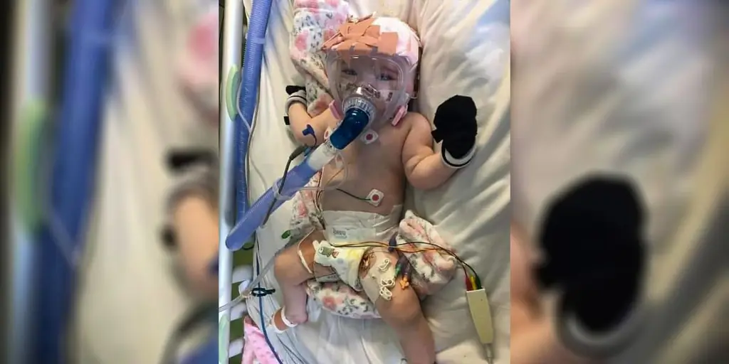 6-месячная девочка, которая пережила операцию на сердце и теперь борется с COVID-19, напоминает нам, что жизнь - это подарок