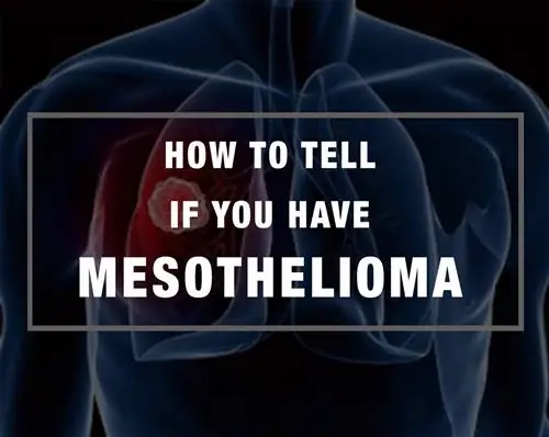 Как узнать, есть ли у вас мезотелиома