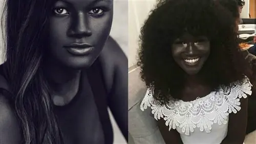 Девушка, над которой издевались из-за цвета кожи, рассказала миру, как лучше всего обрести уверенность в себе