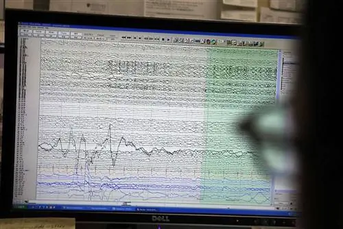 Помогают ли вам антидепрессанты? Мозговые волны могут предсказывать