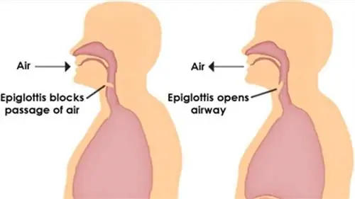 9 фактов об икоте, которых вы не знали
