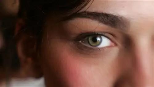 Искусственная радужка одобрена FDA - вот на что она способна