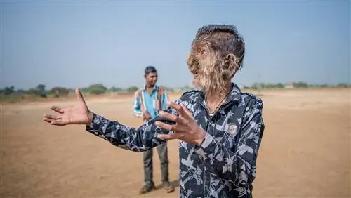 Путаница с лекарствами приводит к тому, что у детей развивается «синдром оборотня»