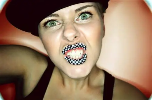 миндалевидное тело