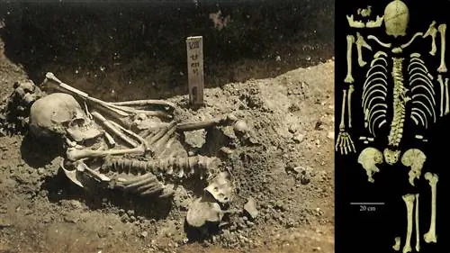 3000-летняя жертва нападения акулы найдена