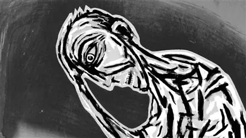 Самая изнурительная болезнь в мире не только в вашей голове