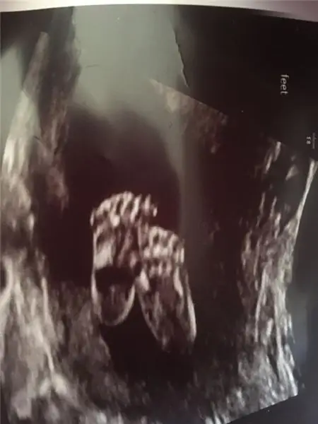 Наш второй ребенок