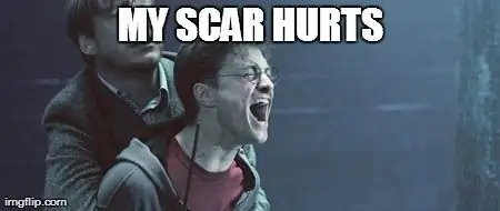 Мой шрам болит, или Почему я эмо о переезде