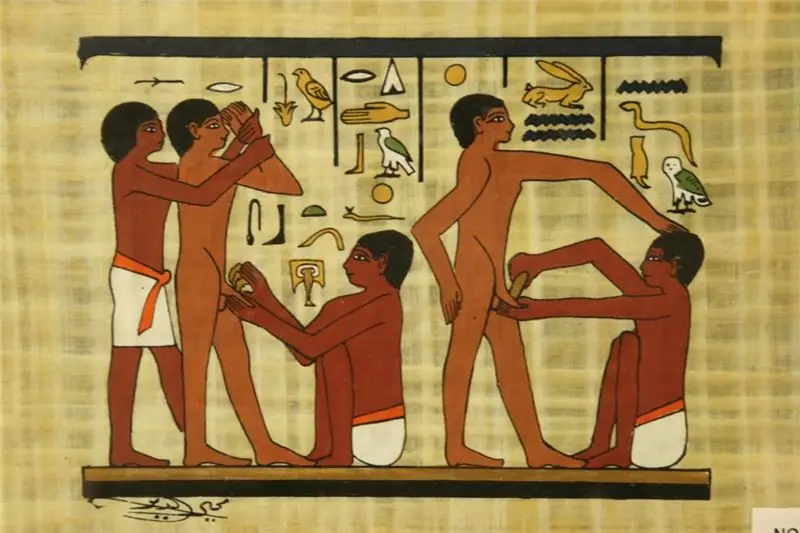 Обрезание: наука, вера или суеверие? Обрезание и наука