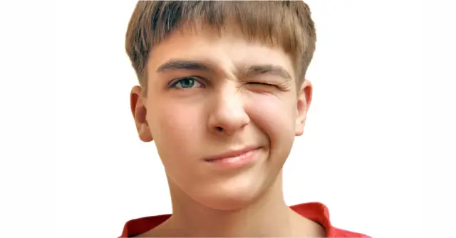 TikTok tic: когда синдром Туретта стал вирусным