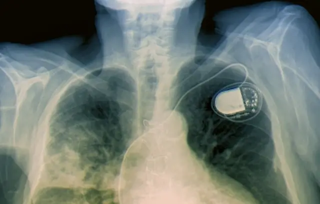 «Всплывающие мегаполисы» привлекают исследователей из Гарварда