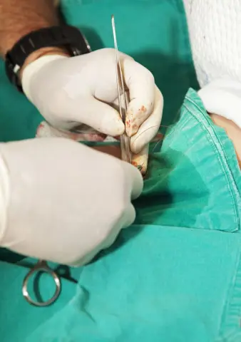 Религиозные группы борются за сохранение обрезания