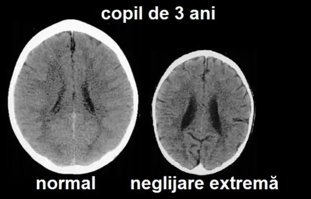 Сканирование мозга показывает, что вы и ваш лучший друг буквально думаете одинаково